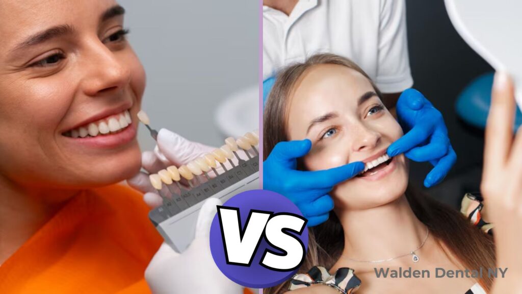 Veneers vs Crowns comparison illustration