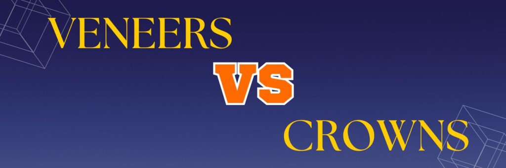 Veneers vs. Crowns